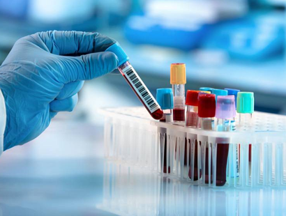 Wafid Medical Blood Examination